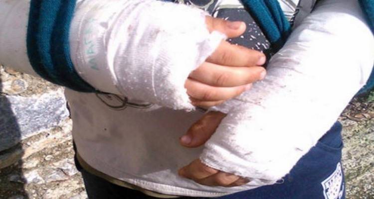 Λέσβος: Μαθητές «κρέμασαν» 9χρονο σε μπασκέτα