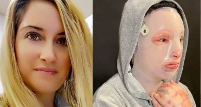 Επίθεση με βιτριόλι: Όγδοο χειρουργείο για την Ιωάννα | Γολγοθάς δίχως τέλος
